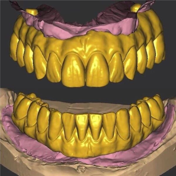 Professional full arch implant bridge CAD design service showing 3D digital workflow and STL file output