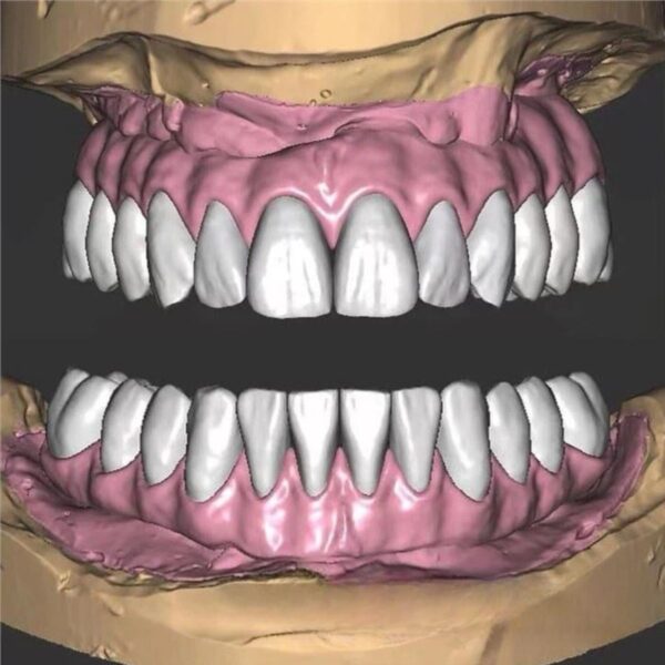 Professional full zirconia design CAD service showing full contour restoration workflow and digital modeling process