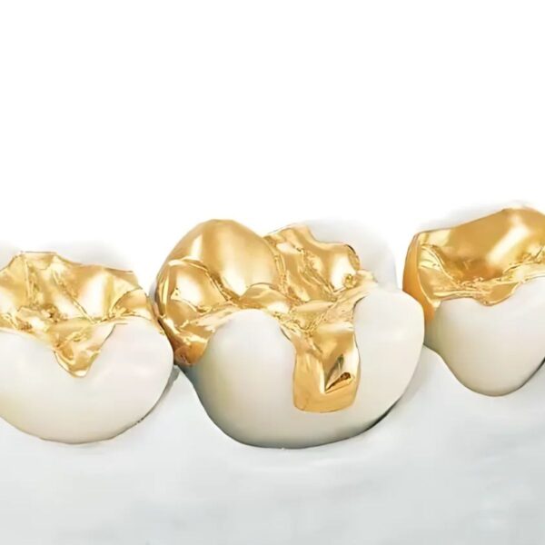 Professional inlay onlay design CAD service showing precision dental restoration workflow and digital modeling