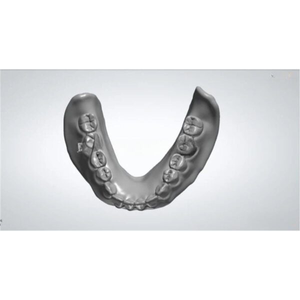 Acrylic Denture Design Full Arch Digital CAD