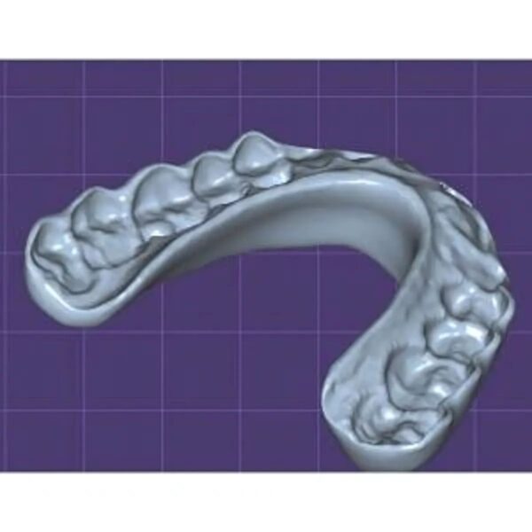 Dental Splint Design Night Guard for 3D Printing